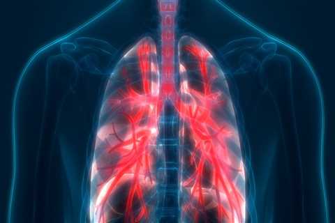 Where is the most common mesothelioma in the world?