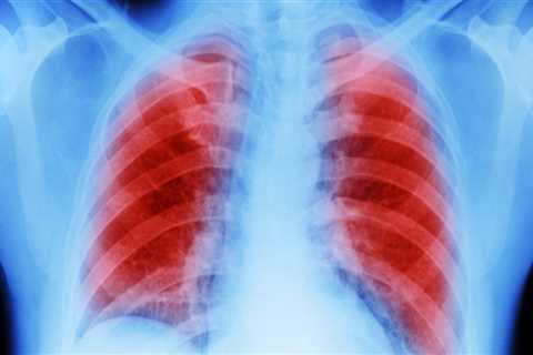 What part of the lung does mesothelioma affect?