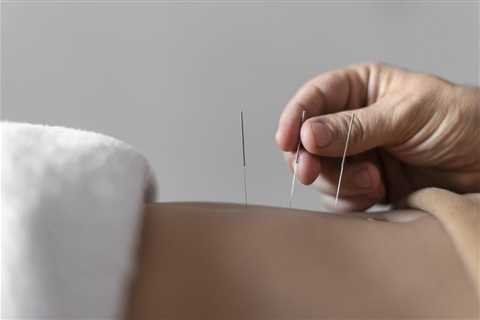 The Benefits of Acupuncture in Digestive Disorders