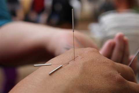 THE BENEFITS OF ACUPUNCTURE FOR PTSD SYMPTOM RELIEF