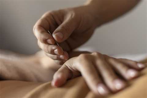 THE BENEFITS OF ACUPUNCTURE FOR ENDOMETRIOSIS PAIN RELIEF