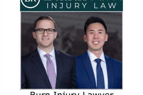 Burn Injury Lawyer Ellicott City, MD